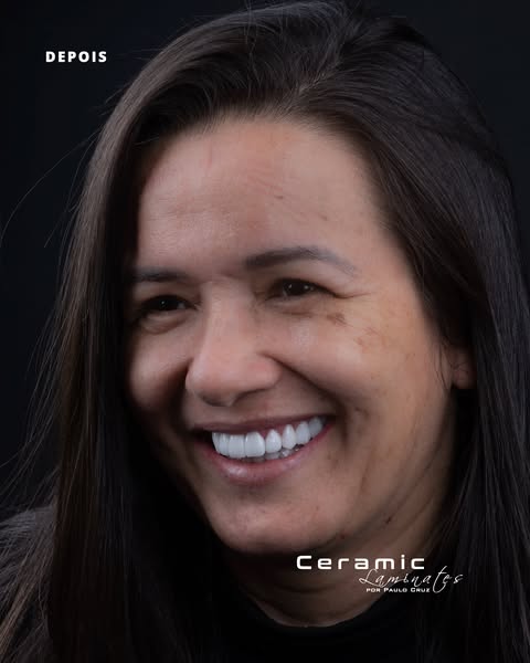 Caso clínico 3 depois